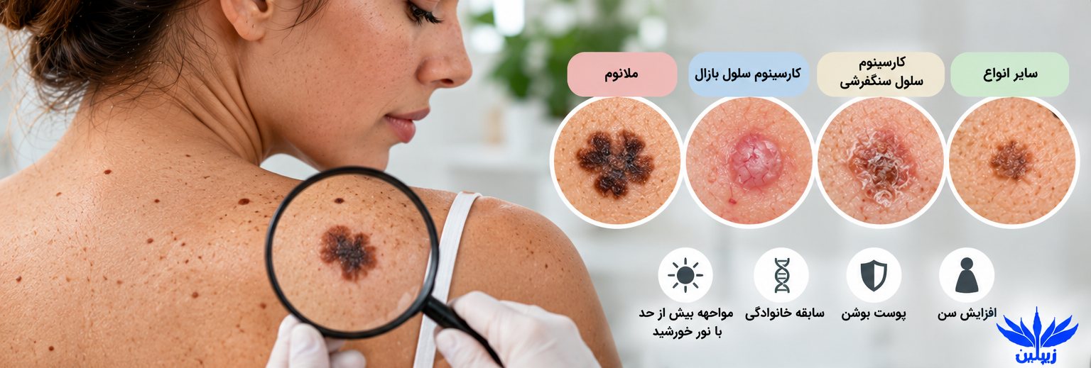 سرطان پوست چیست؟ | علائم، انواع و روش‌های درمان