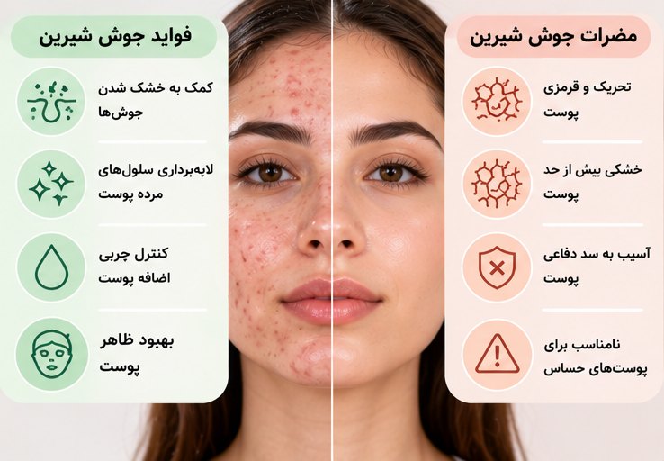 جوش شیرین برای آکنه | فواید و مضرات آن برای پوست
