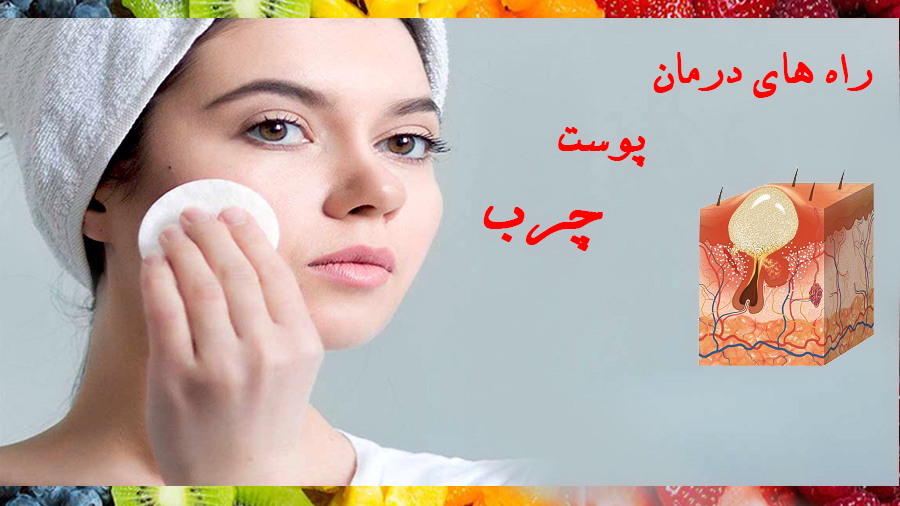 درمان پوست چرب
