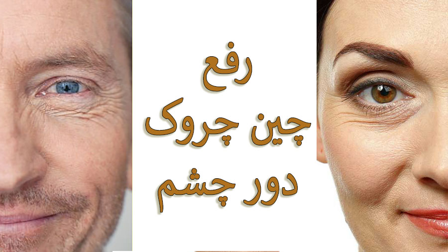 چروک دور چشم