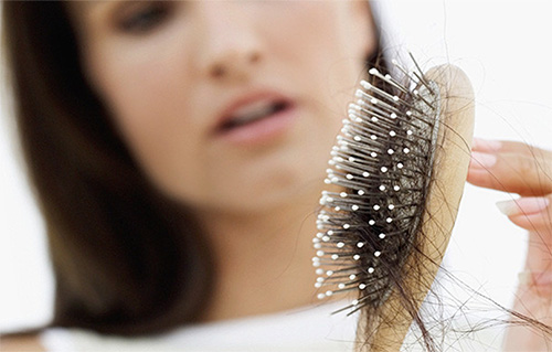 ریزش مو در اثر کم خوابی