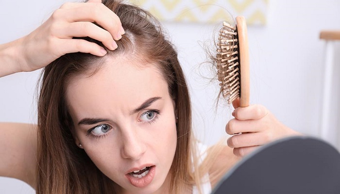 ریزش مو بر اثر پسوریازیس پوست سر