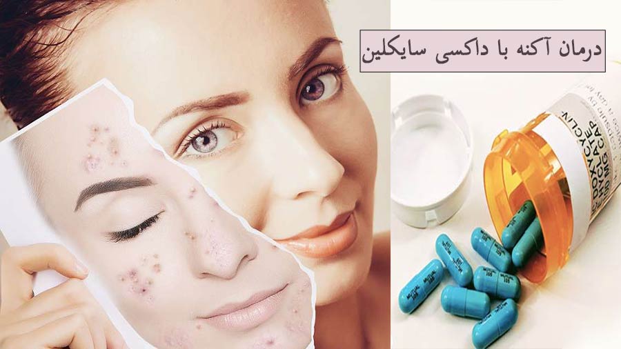 داکسی سایکلین