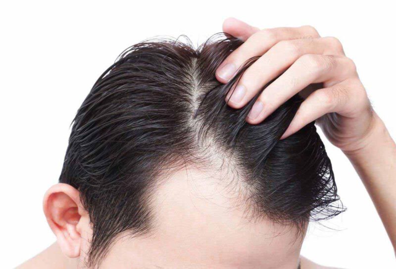 حالت دادن و در عین حال مراقبت از مو آقایان
