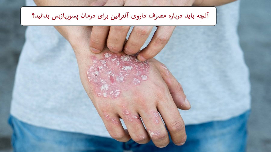 آنترالین