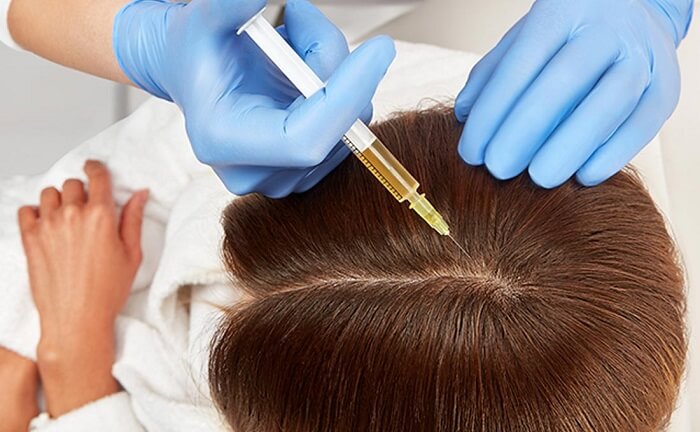 فرایند مزوتراپی مو ها چگونه است؟