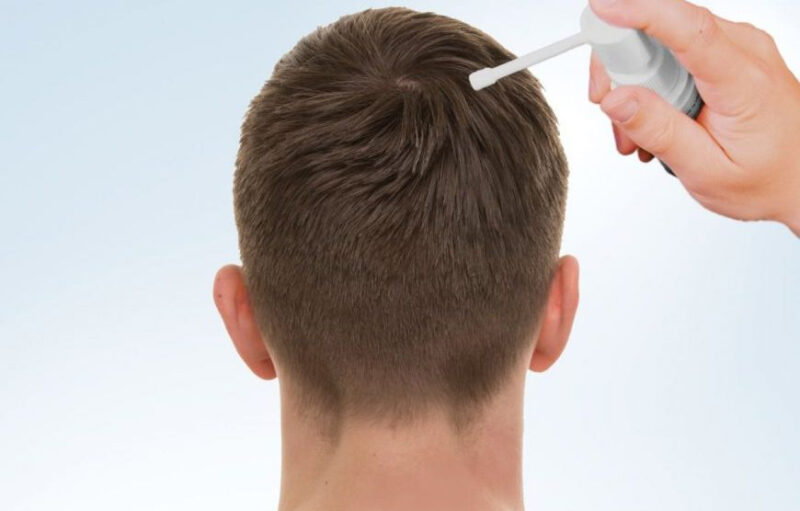 طزیقه استفاده از ماینوکسیدیل برای مو.