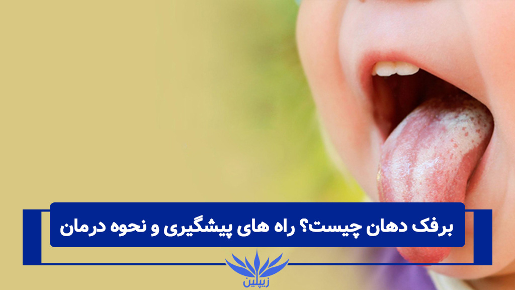برفک دهان