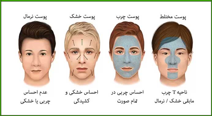 مراقبت از پوست در ماه رمضان بر اساس نوع پوست